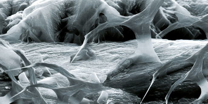biofilm.jpg Anolyte baut Biofilm ab und saniert die Lietungen.
Mikrobiell induzierte Korrosion wird verhindert